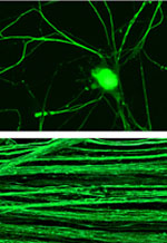 DRG neurons